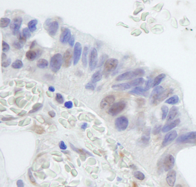 RNF20 Antibody in Immunohistochemistry (Paraffin) (IHC (P))