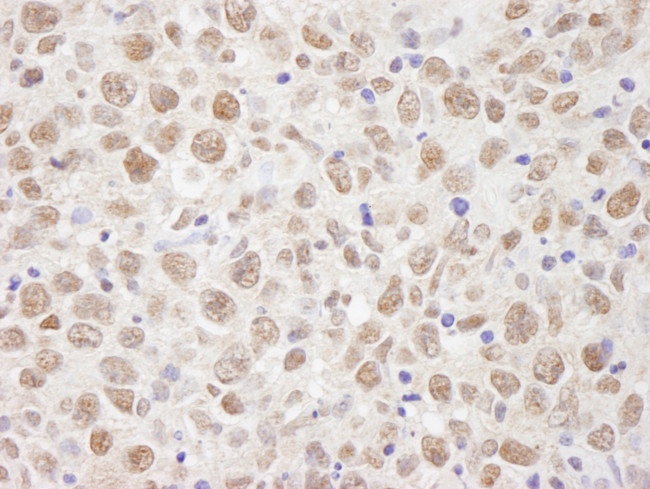 BAAT1 Antibody in Immunohistochemistry (Paraffin) (IHC (P))