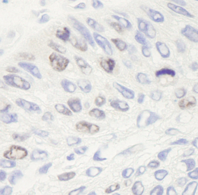 Topo II Alpha Antibody in Immunohistochemistry (Paraffin) (IHC (P))