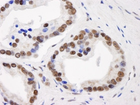 GTF2I/TFII-I Antibody in Immunohistochemistry (Paraffin) (IHC (P))