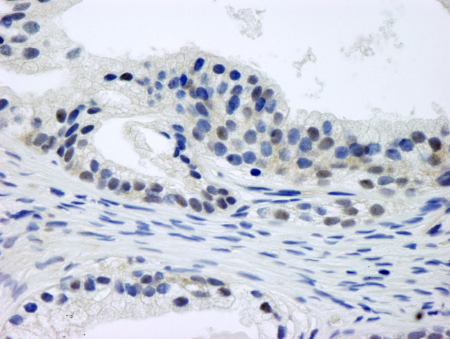 CSN1 Antibody in Immunohistochemistry (Paraffin) (IHC (P))