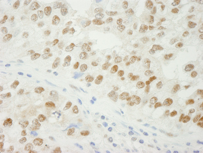 ADNP Antibody in Immunohistochemistry (Paraffin) (IHC (P))