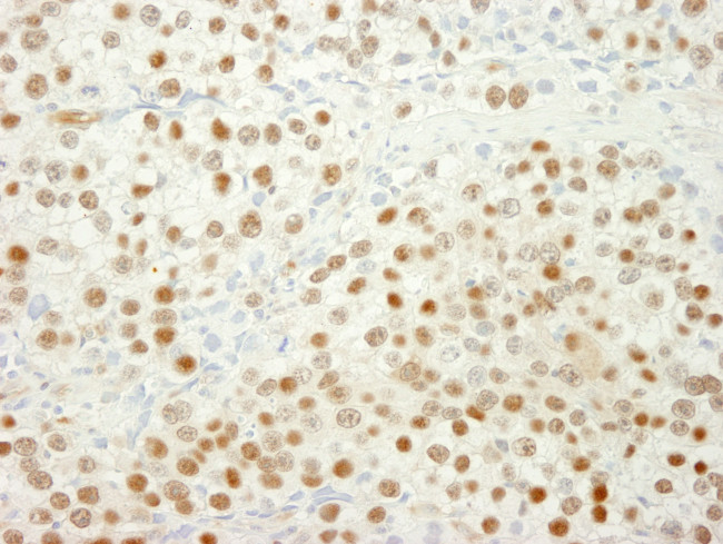 MSH6 Antibody in Immunohistochemistry (Paraffin) (IHC (P))