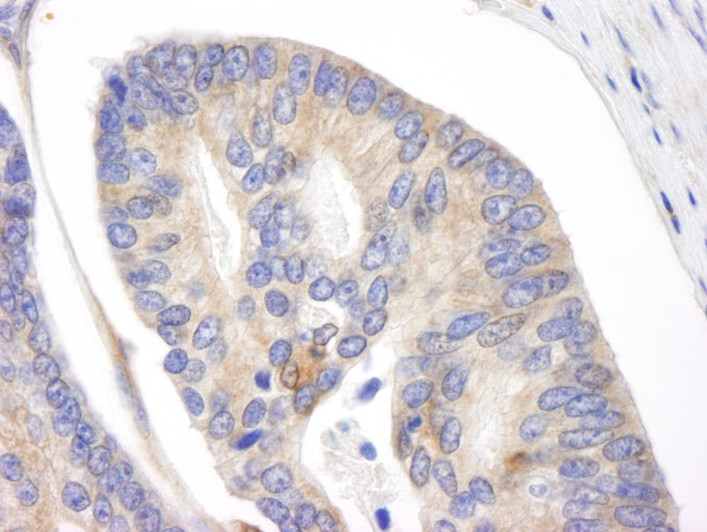 BID Antibody in Immunohistochemistry (Paraffin) (IHC (P))
