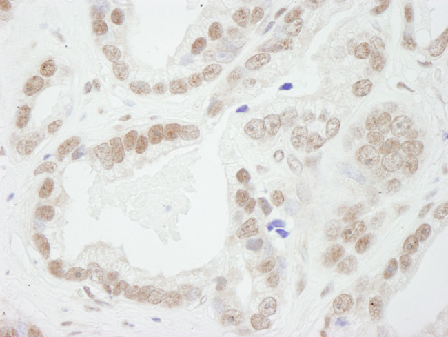 Bub3 Antibody in Immunohistochemistry (Paraffin) (IHC (P))