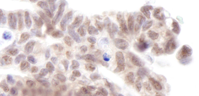 AF9 Antibody in Immunohistochemistry (Paraffin) (IHC (P))