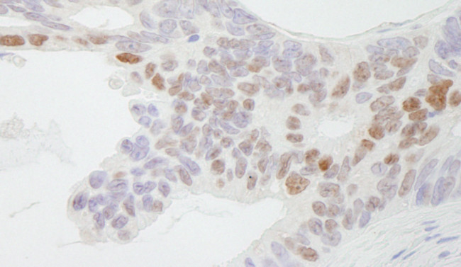 CDX2 Antibody in Immunohistochemistry (Paraffin) (IHC (P))