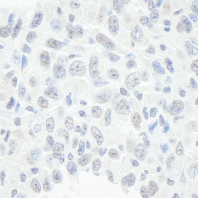 BAF57/SMARCE1 Antibody in Immunohistochemistry (Paraffin) (IHC (P))