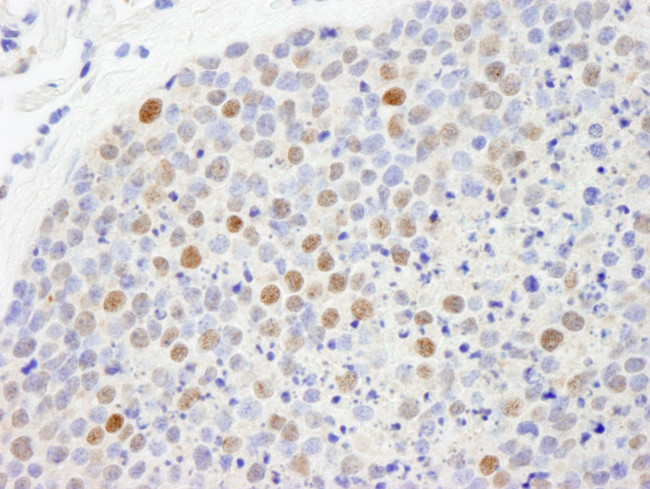 CBX5 Antibody in Immunohistochemistry (Paraffin) (IHC (P))