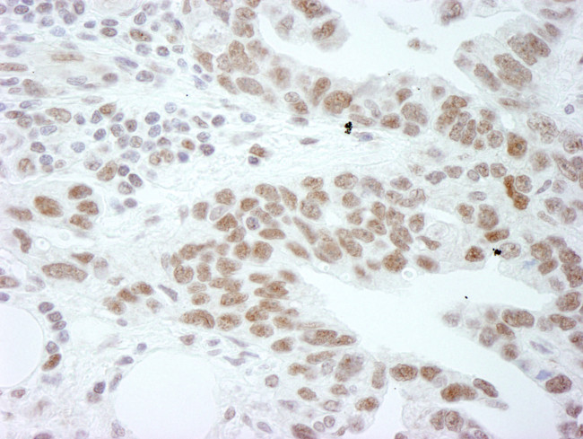 DDX1 Antibody in Immunohistochemistry (Paraffin) (IHC (P))
