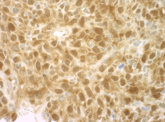 4EBP1 Antibody in Immunohistochemistry (Paraffin) (IHC (P))