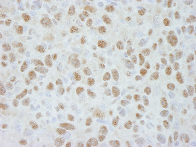 DDB1 Antibody in Immunohistochemistry (Paraffin) (IHC (P))