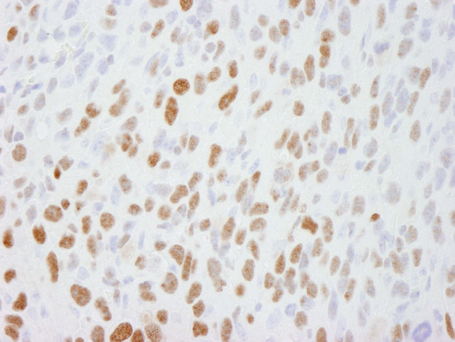 DBC1/p30 DBC Antibody in Immunohistochemistry (Paraffin) (IHC (P))