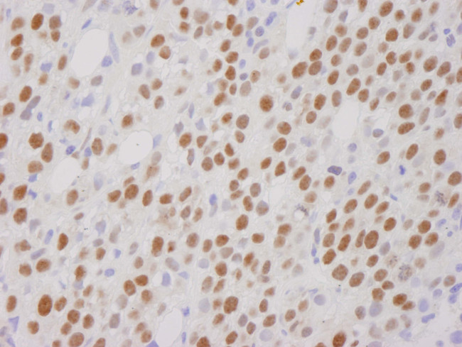 CoREST Antibody in Immunohistochemistry (Paraffin) (IHC (P))
