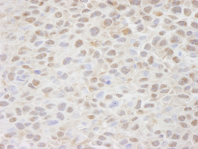 CSE1 Antibody in Immunohistochemistry (Paraffin) (IHC (P))
