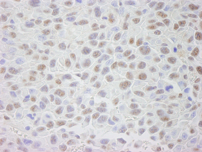 CRM1 Antibody in Immunohistochemistry (Paraffin) (IHC (P))
