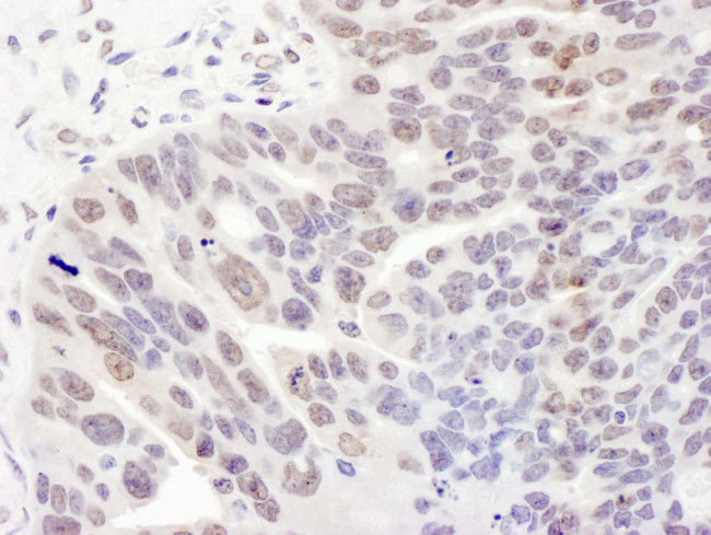REST Antibody in Immunohistochemistry (Paraffin) (IHC (P))