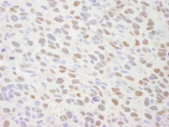 TIF1 Alpha/TRIM24 Antibody in Immunohistochemistry (Paraffin) (IHC (P))