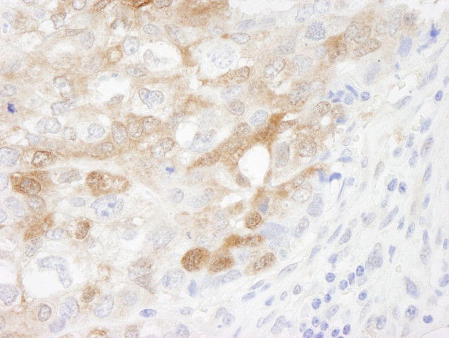 CRABP2 Antibody in Immunohistochemistry (Paraffin) (IHC (P))