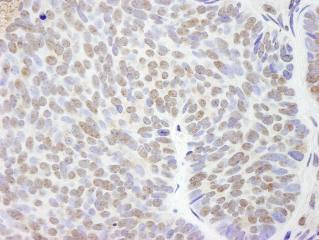 UBCH7 Antibody in Immunohistochemistry (Paraffin) (IHC (P))