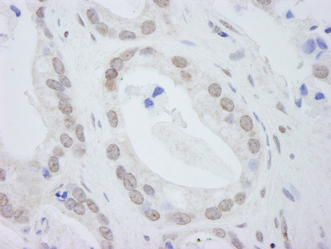 DDX24 Antibody in Immunohistochemistry (Paraffin) (IHC (P))