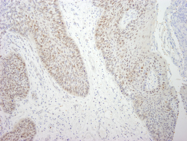 DDX21 Antibody in Immunohistochemistry (Paraffin) (IHC (P))