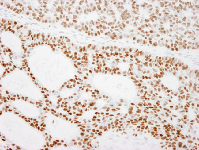 RCC2 Antibody in Immunohistochemistry (Paraffin) (IHC (P))