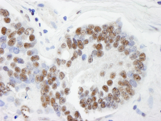 THRAP3/TRAP150 Antibody in Immunohistochemistry (Paraffin) (IHC (P))