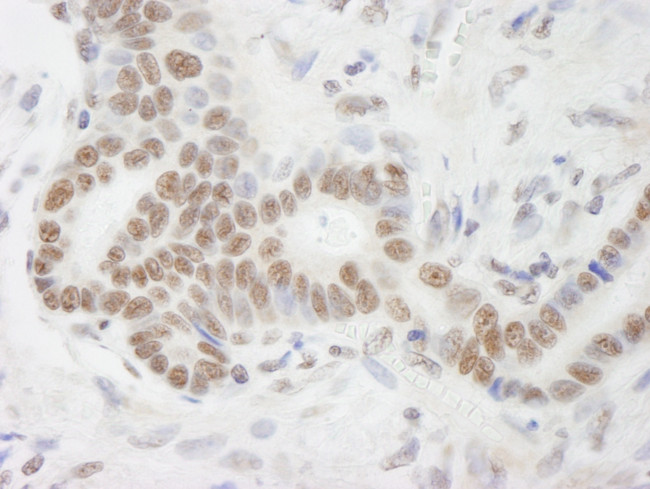 DHX9 Antibody in Immunohistochemistry (Paraffin) (IHC (P))