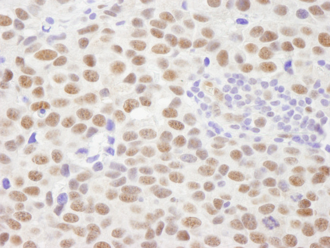 PPM1G Antibody in Immunohistochemistry (Paraffin) (IHC (P))