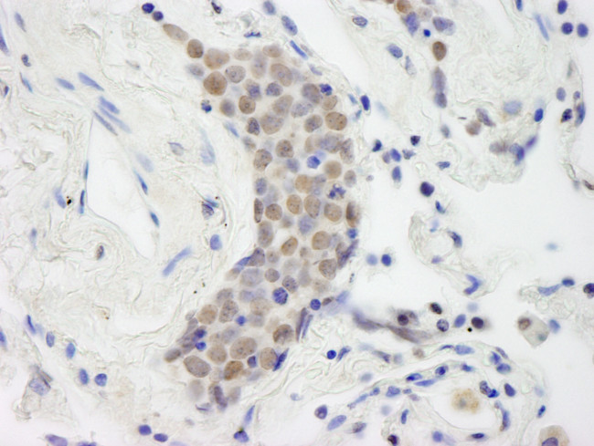 Topo II Beta Antibody in Immunohistochemistry (Paraffin) (IHC (P))