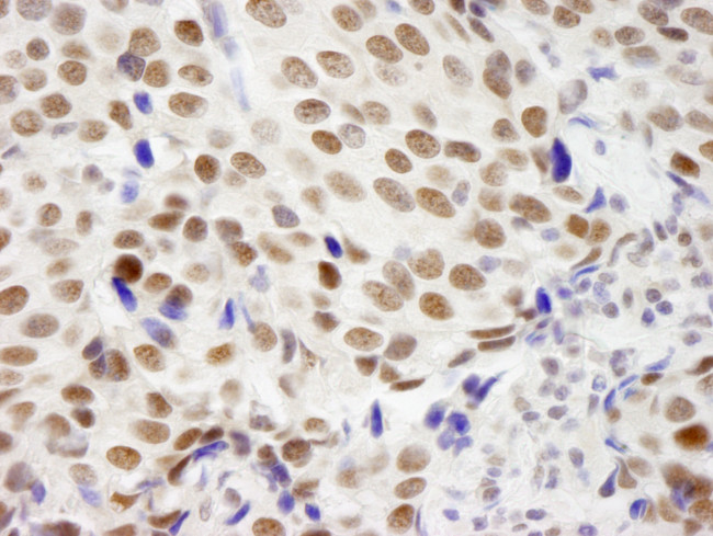 ZNF261 Antibody in Immunohistochemistry (Paraffin) (IHC (P))