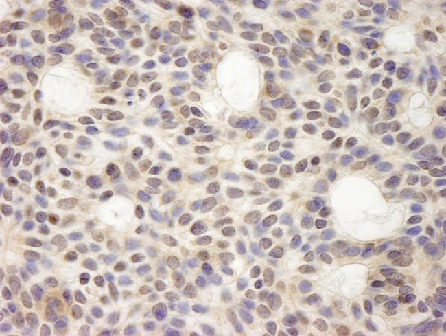 HURP/DLG7 Antibody in Immunohistochemistry (Paraffin) (IHC (P))