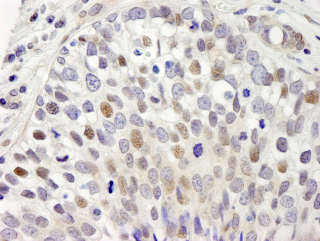 hSET1 Antibody in Immunohistochemistry (Paraffin) (IHC (P))