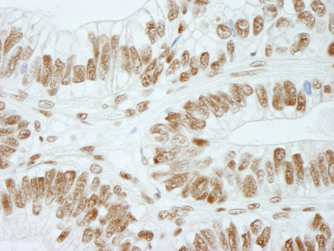 RbBP5 Antibody in Immunohistochemistry (Paraffin) (IHC (P))