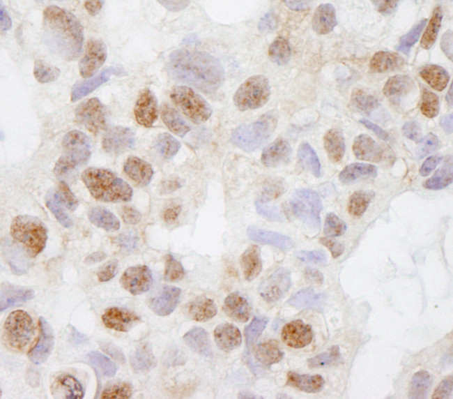 DHX38 Antibody in Immunohistochemistry (Paraffin) (IHC (P))