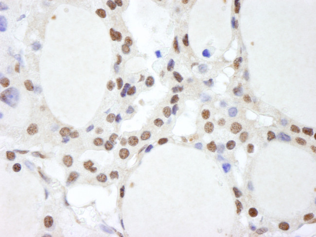 CSN2 Antibody in Immunohistochemistry (Paraffin) (IHC (P))