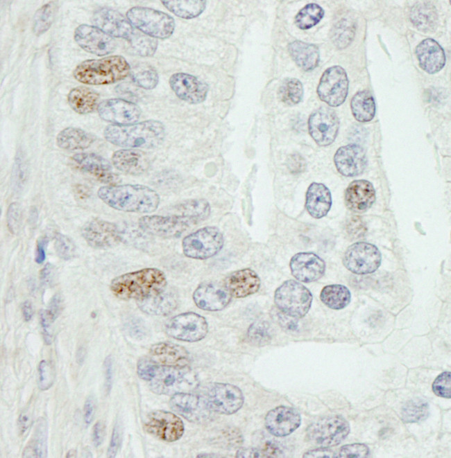 MED18 Antibody in Immunohistochemistry (Paraffin) (IHC (P))