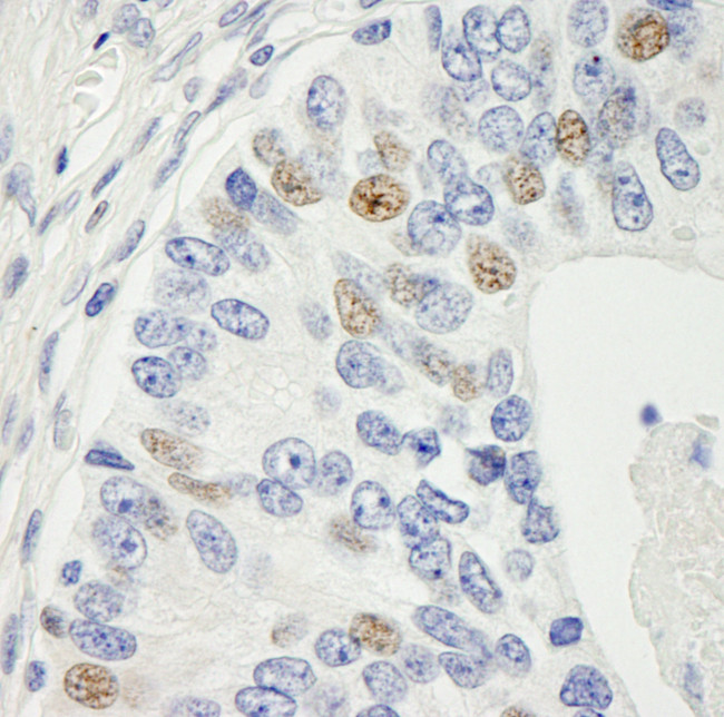 MAD1 Antibody in Immunohistochemistry (Paraffin) (IHC (P))