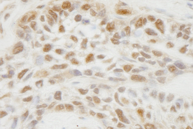 JMJD1C Antibody in Immunohistochemistry (Paraffin) (IHC (P))