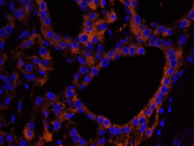 NF2 Antibody in Immunohistochemistry (Paraffin) (IHC (P))
