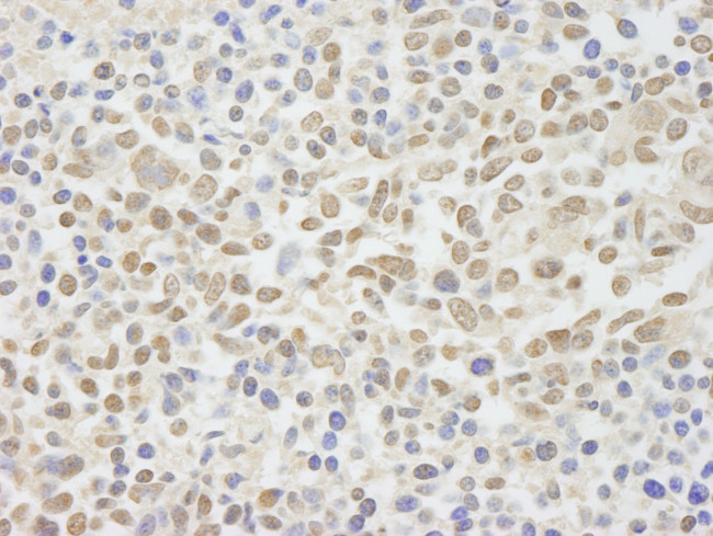 NIF1 Antibody in Immunohistochemistry (Paraffin) (IHC (P))