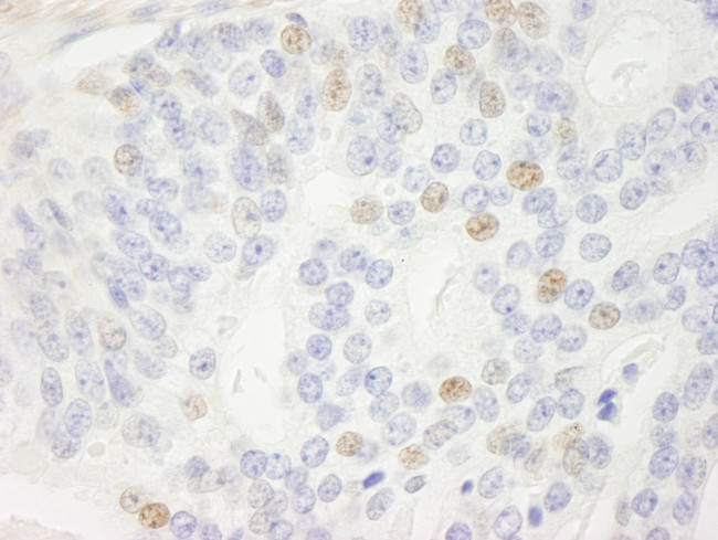 p14ARF Antibody in Immunohistochemistry (Paraffin) (IHC (P))