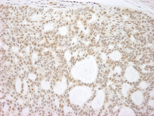 p73 Antibody in Immunohistochemistry (Paraffin) (IHC (P))