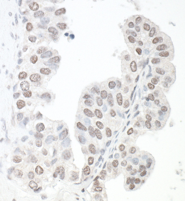 SMC6 Antibody in Immunohistochemistry (Paraffin) (IHC (P))
