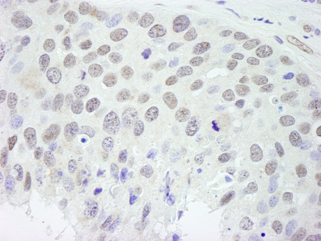 RBM9 Antibody in Immunohistochemistry (Paraffin) (IHC (P))
