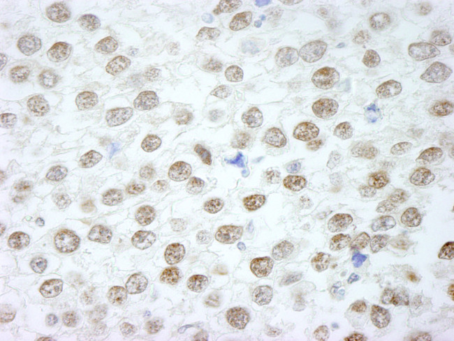 RIF1 Antibody in Immunohistochemistry (Paraffin) (IHC (P))