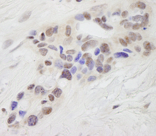 STAT6 Antibody in Immunohistochemistry (Paraffin) (IHC (P))