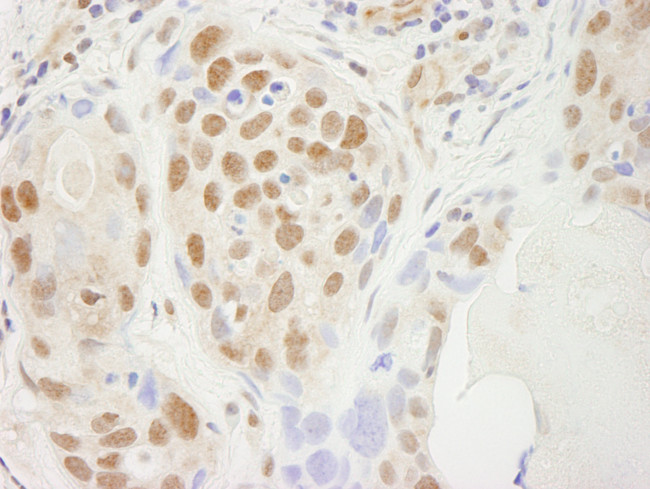 SUPT5H Antibody in Immunohistochemistry (Paraffin) (IHC (P))