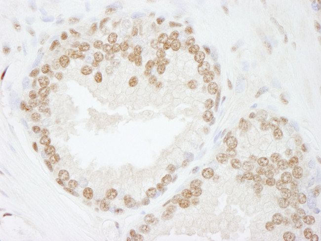 SMARCC2/BAF170 Antibody in Immunohistochemistry (Paraffin) (IHC (P))
